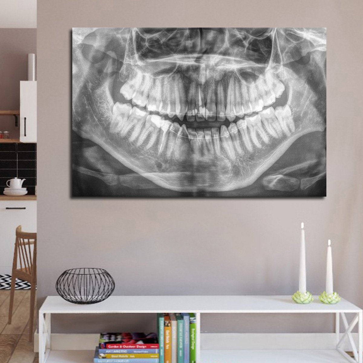 Panoramic X Ray Multi Panel Canvas Wall Art