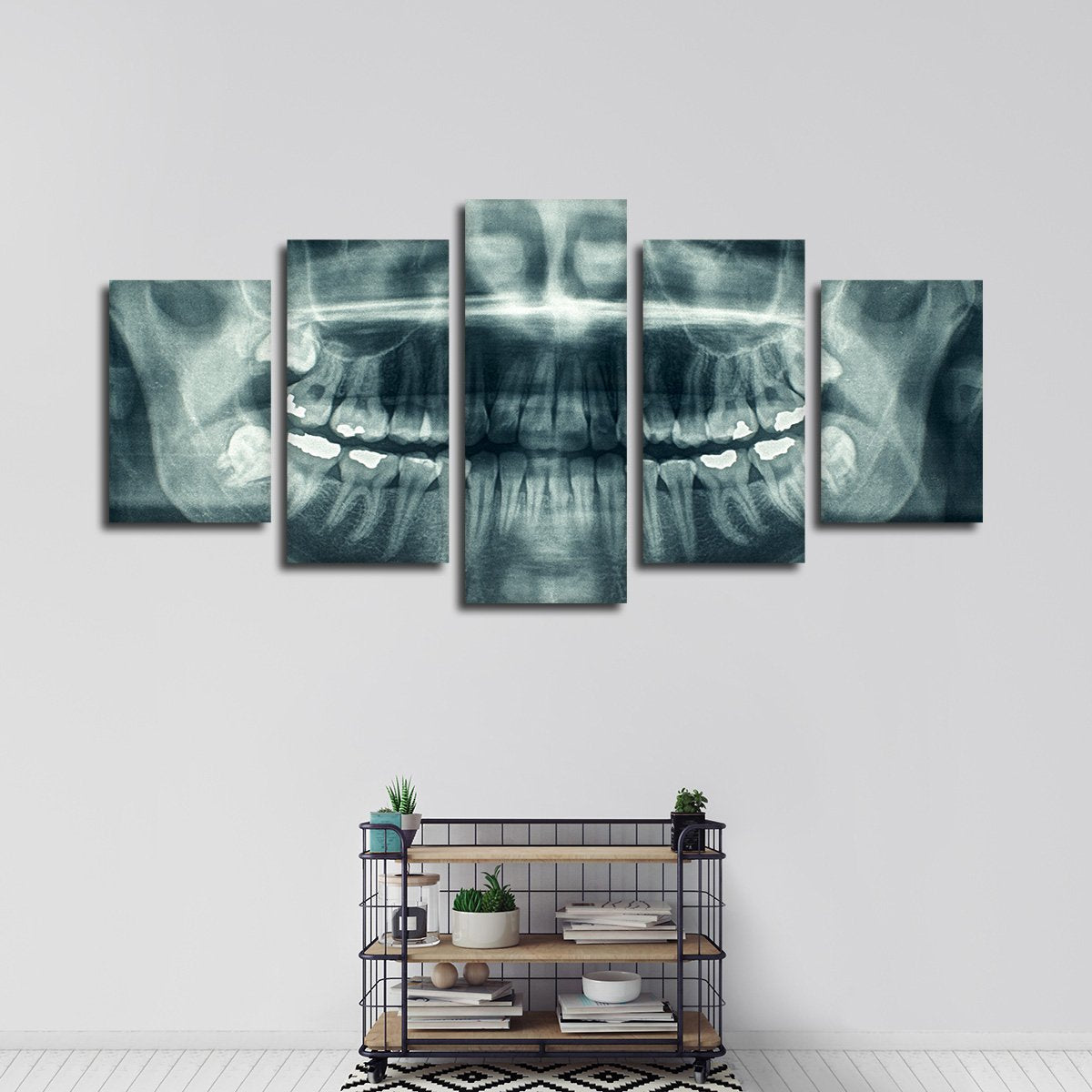 Dental X Ray Multi Panel Canvas Wall Art