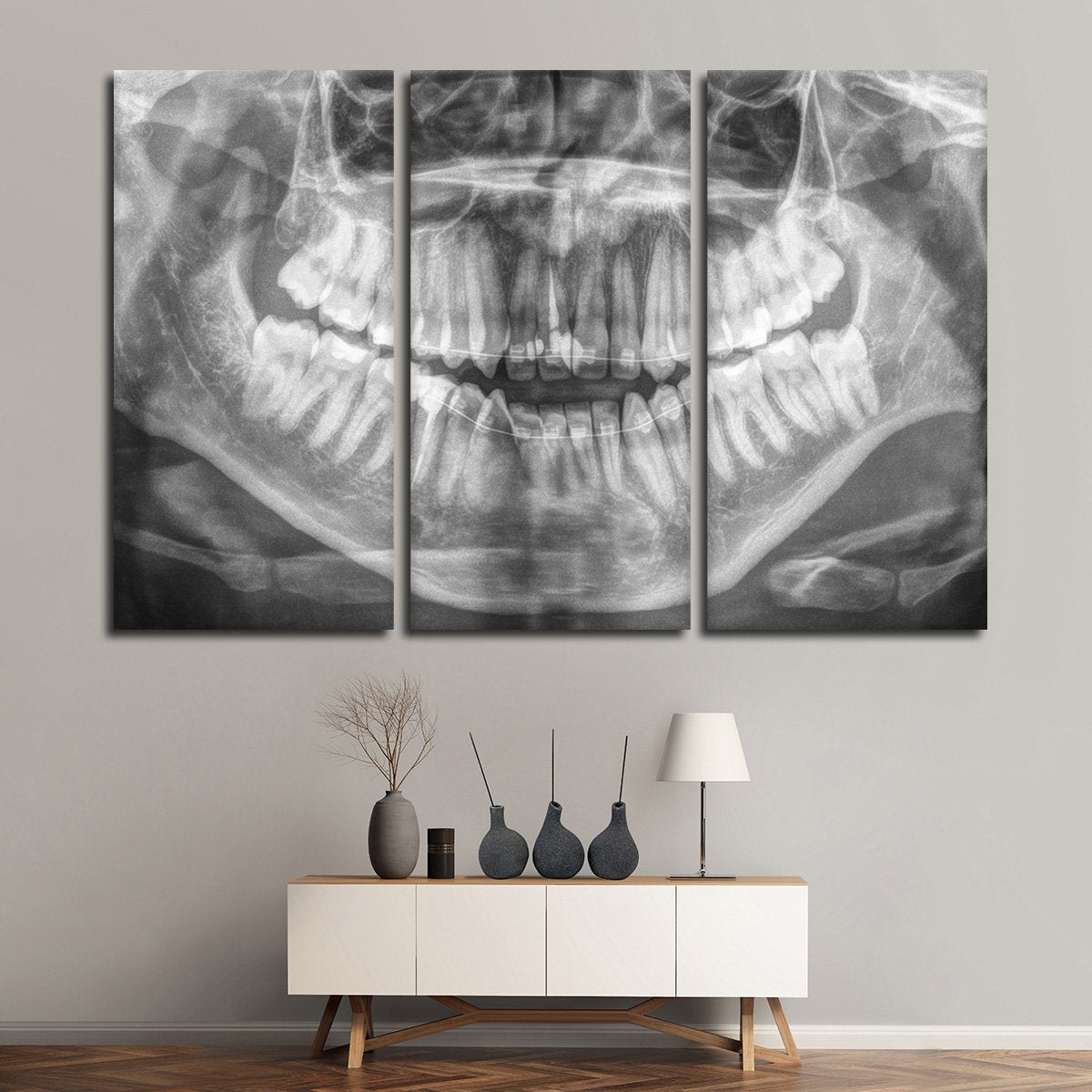 Panoramic X Ray Multi Panel Canvas Wall Art
