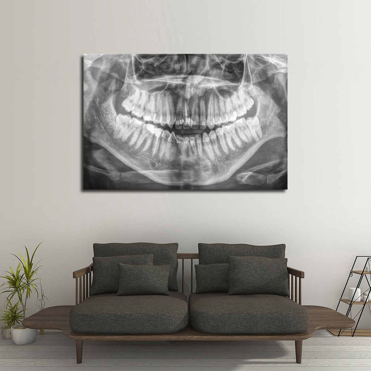 Panoramic X Ray Multi Panel Canvas Wall Art